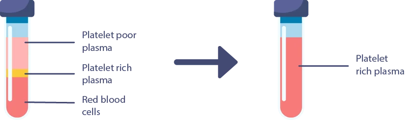 Stap 2: Centrifugeren