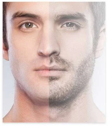 Stap 3: Verzamelen van de follikels