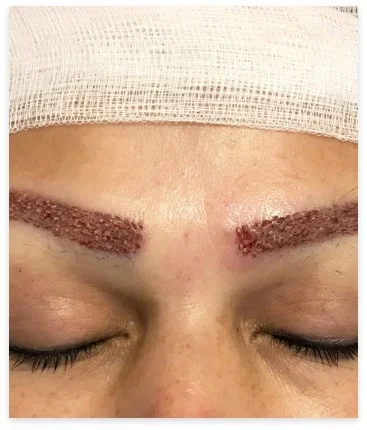 Stap 3: Gespecialiseerde Extractie