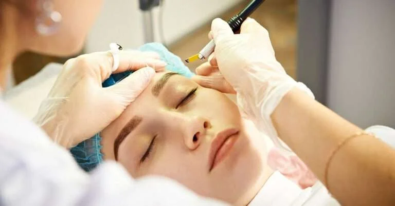 Wenkbrauw Transplantatie